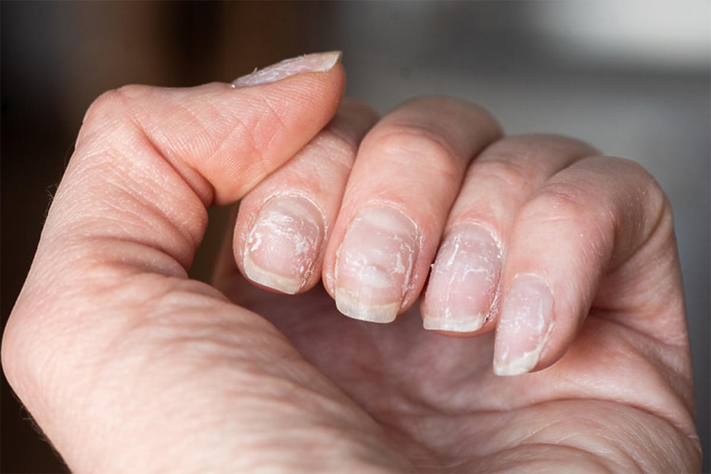 Tips to Prevent Nail Damage